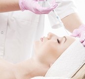 玻尿酸注射微整型