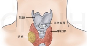 甲狀腺功能低下