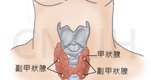 甲狀腺功能亢進