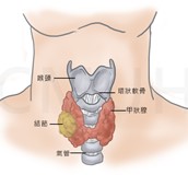 甲狀腺結節