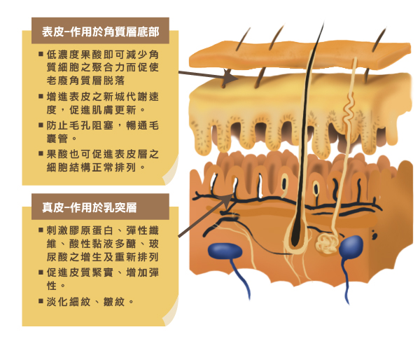 果酸換膚
