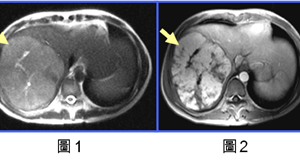 磁振造影簡介(MRI)