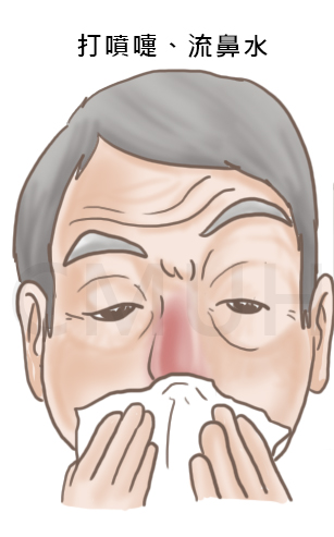 鼻過敏1