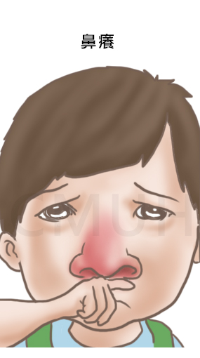 鼻過敏3