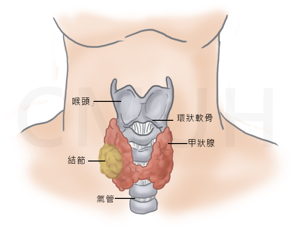 甲狀腺