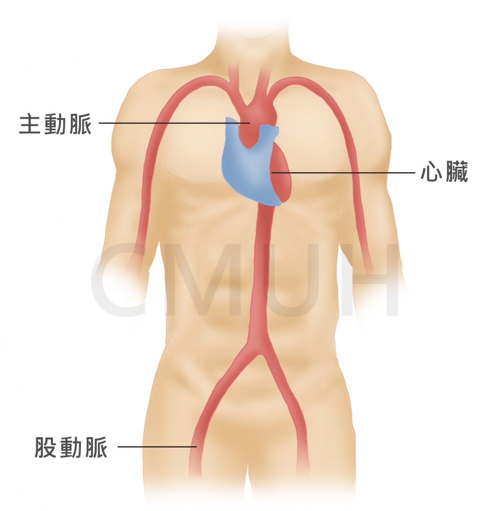 心導管