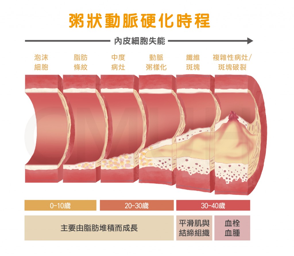 粥狀動脈硬化時程