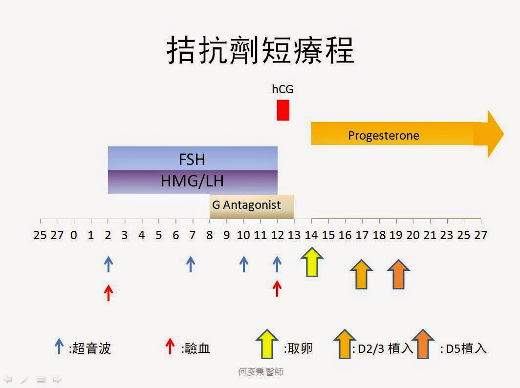 試管嬰兒拮抗劑短療程