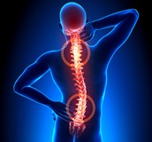 哪些病人會有類風濕因子