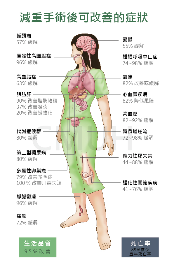 減重手術可改善疾病