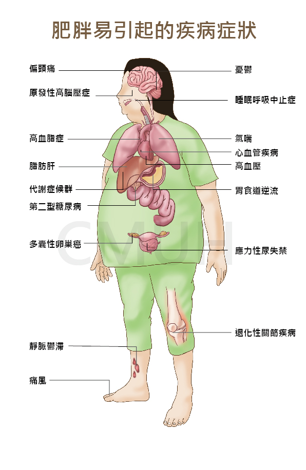 減重手術可改善疾病